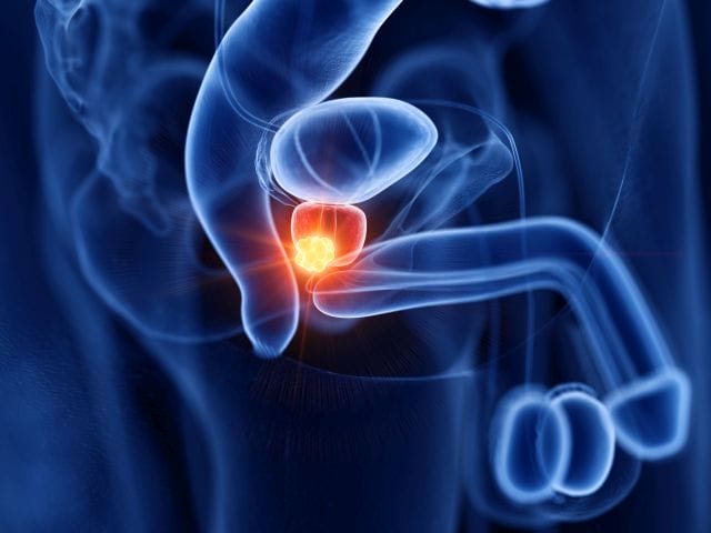 3D-Illustration der männlichen Genitalien mit bunt hervorgehobener Prostata als Symbolbild für Prostatakrebs, für dessen Behandlung es neue Ergebnisse zu Talazoparib gibt.