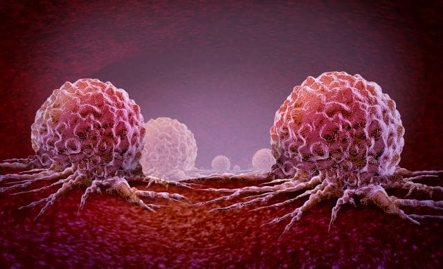 3D-Illustration von zwei Krebszellen als Symbolbild für die Metastasierung, die nach neuesten Erkenntnissen vom Interleukin 22 IL-22 angetrieben wird.